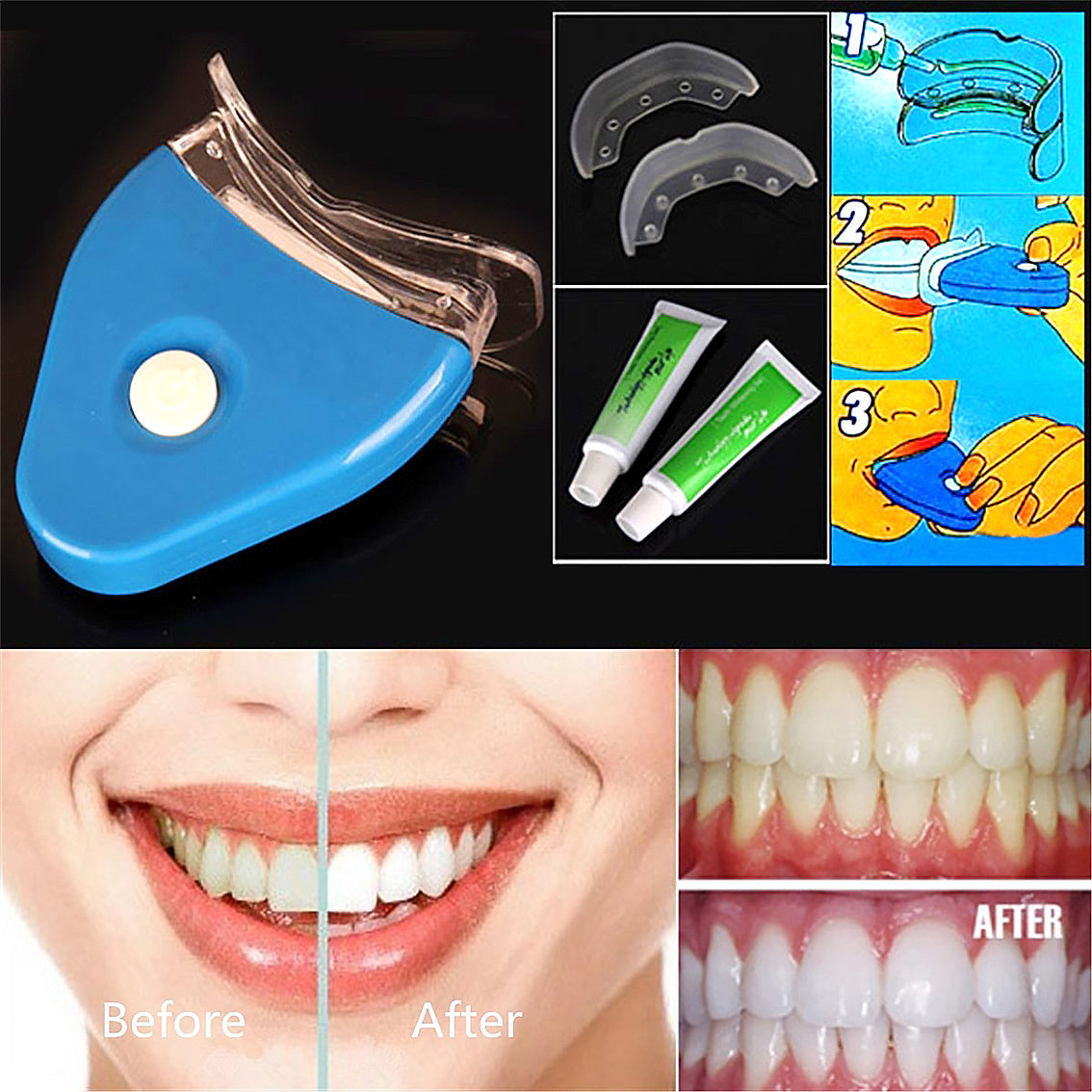 Oral Gel Teeth Tooth Whitening